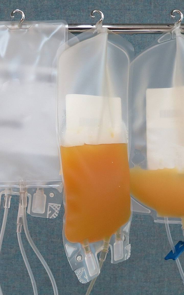 A China proibiu a troca de sangue antienvelhecimento